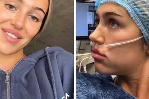 Delilah Hamlin Shares Hilarious TikTok of Herself Waking Up From Anesthesia After Wisdom Teeth..