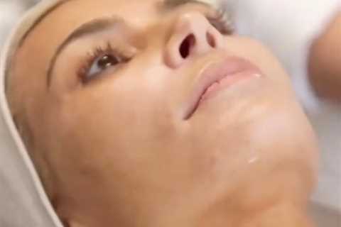 Kim Kardashian shows off real skin with ‘fine lines, dry cracked lips & irritated blemishes’ in ..