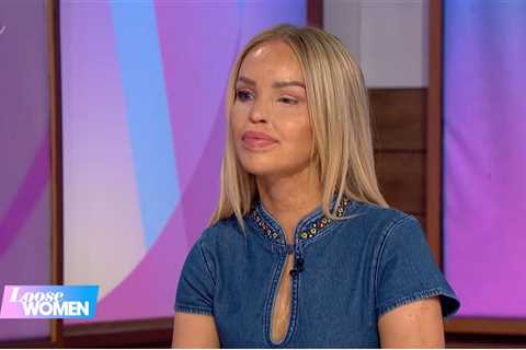 Katie Piper returns to Loose Women after major surgery, revealing tissue from donor was used to fix ..