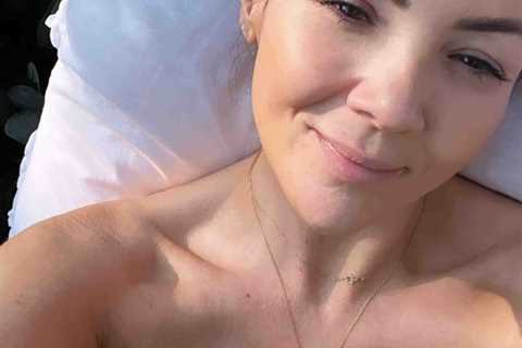 Martine McCutcheon goes ‘topless’ while sunbathing as she reveals anxiety struggle