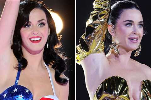 Katy Perry -- Good Genes Or Good Docs?!