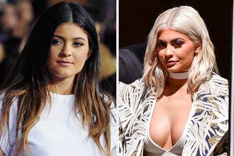 Kylie Jenner Just Casually Confirmed The Years-Long Speculation That She Had A Secret Boob Job As A ..