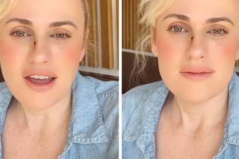 Rebel Wilson Details Stunt Accident That Sent Her to Hospital for Stitches