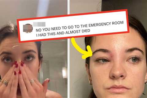 This Dance Moms Star Just Warned Millions About The Dangers Of Popping Pimples In The Triangle Of..