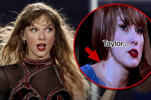 Taylor Swift Appears to Have a Hickey in Sweden, After Travis Kelce Getaway