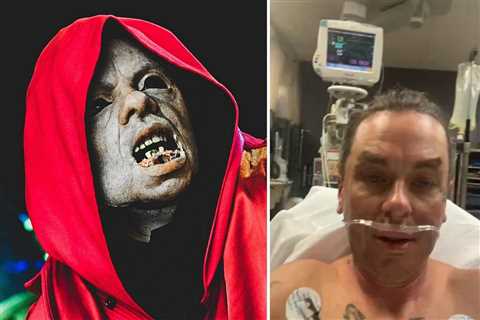 Slipknot’s Sid Wilson Hospitalized With Burns, ‘I Do Know Better’