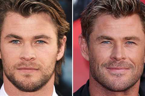 Chris Hemsworth -- Good Genes or Good Docs?!