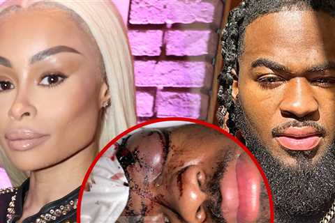 Blac Chyna Sued by Ex-Boyfriend Claiming She Beat Him Up In His Sleep