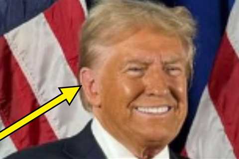 A Picture Of Donald Trump's Face Being Two Completely Different Colors Is Going Viral For Obvious..