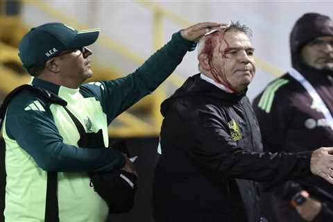 Mexico soccer coach Javier Aguirre injured after being hit in head by apparent beer can that was..