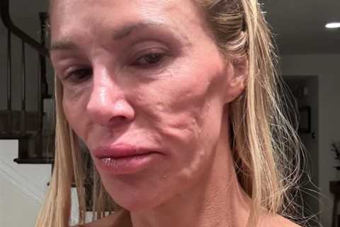 Celebrity Big Brother star unrecognizable after health battle