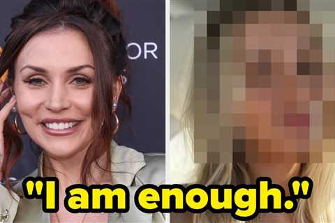 Courtney Stodden Dissolved Her Fillers And People Are Loving Her New Look