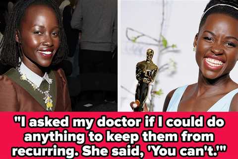 Lupita Nyong'o Received An Unexpected Health Diagnosis The Same Year She Won Her First Oscar