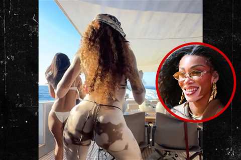 Winnie Harlow Twerks In Tiny Bikini On Yacht