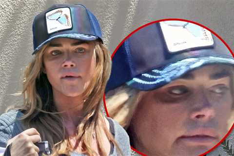 Denise Richards Sports Black Eye Days After Showing Up at Estranged Husband's House