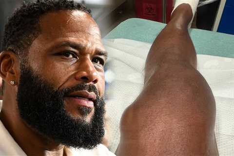 Anthony Anderson Has Bright Yellow Fluid Drained From Knee, on Video