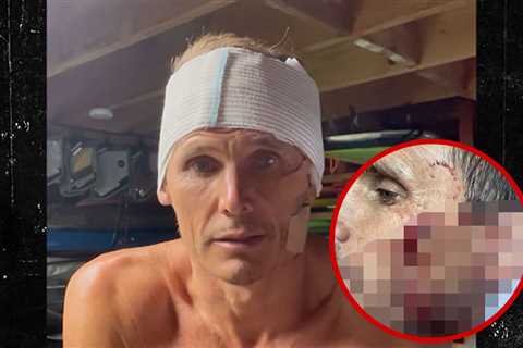 Surfer Jamie Mitchell Suffers Gruesome Cuts in Freak Wipeout