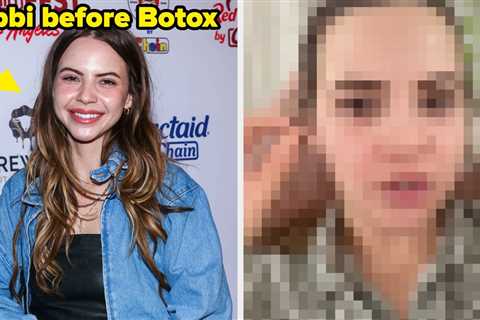 Viral Podcaster Bobbi Althoff Showed The Botched Botox That Left Her Face Paralyzed