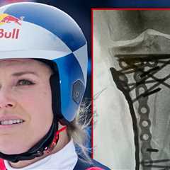 Lindsey Vonn 'Struggling' After Last Surgery, Remains Hospitalized in U.S.