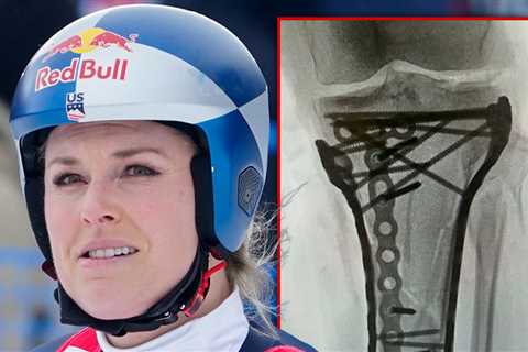 Lindsey Vonn 'Struggling' After Last Surgery, Remains Hospitalized in U.S.