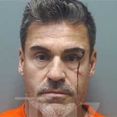 Lindsie Chrisley's Boyfriend Bleeding in Aggravated Assault Mug Shot