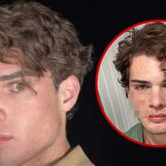 Clavicular Home from Hospital After Suspected Overdose