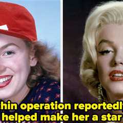 17 Old Hollywood Stars Before And After Cosmetic Surgery
