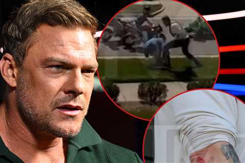 Alan Ritchson Injury Photos Taken by Cops After Street Fight With Neighbor