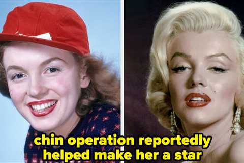 17 Old Hollywood Stars Before And After Cosmetic Surgery