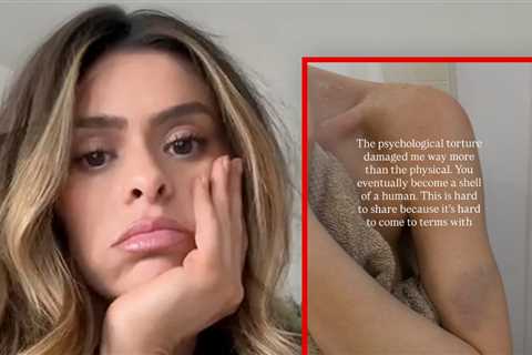 Taylor Frankie Paul Posts Bruised Arm, Opens Up About ‘Psychological Torture’