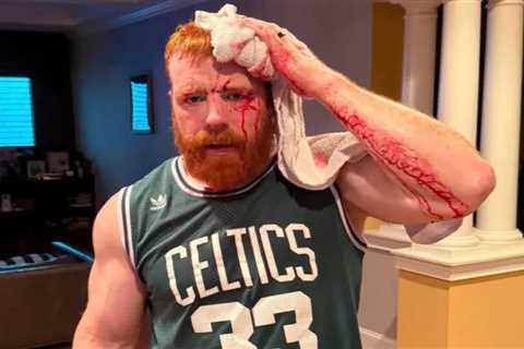 WWE star Sheamus shows off gruesome head injury in bloody ‘gym fail’