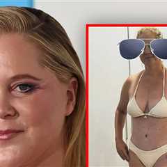 Amy Schumer Shows Off Svelte Figure in Bikini After Major Weight Loss