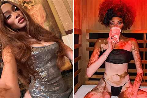 Winnie Harlow Hot Shots To Slay Her 32nd Birthday