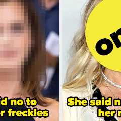 14 Celebs Who Were Told Their Most Distinctive Features Needed “Fixing,” But Embraced Them Instead